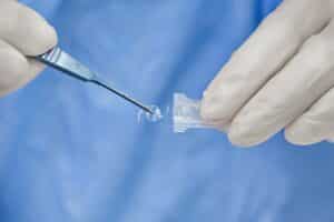 Eye surgeon withdraws an IOL from a protective case during cataract surgery