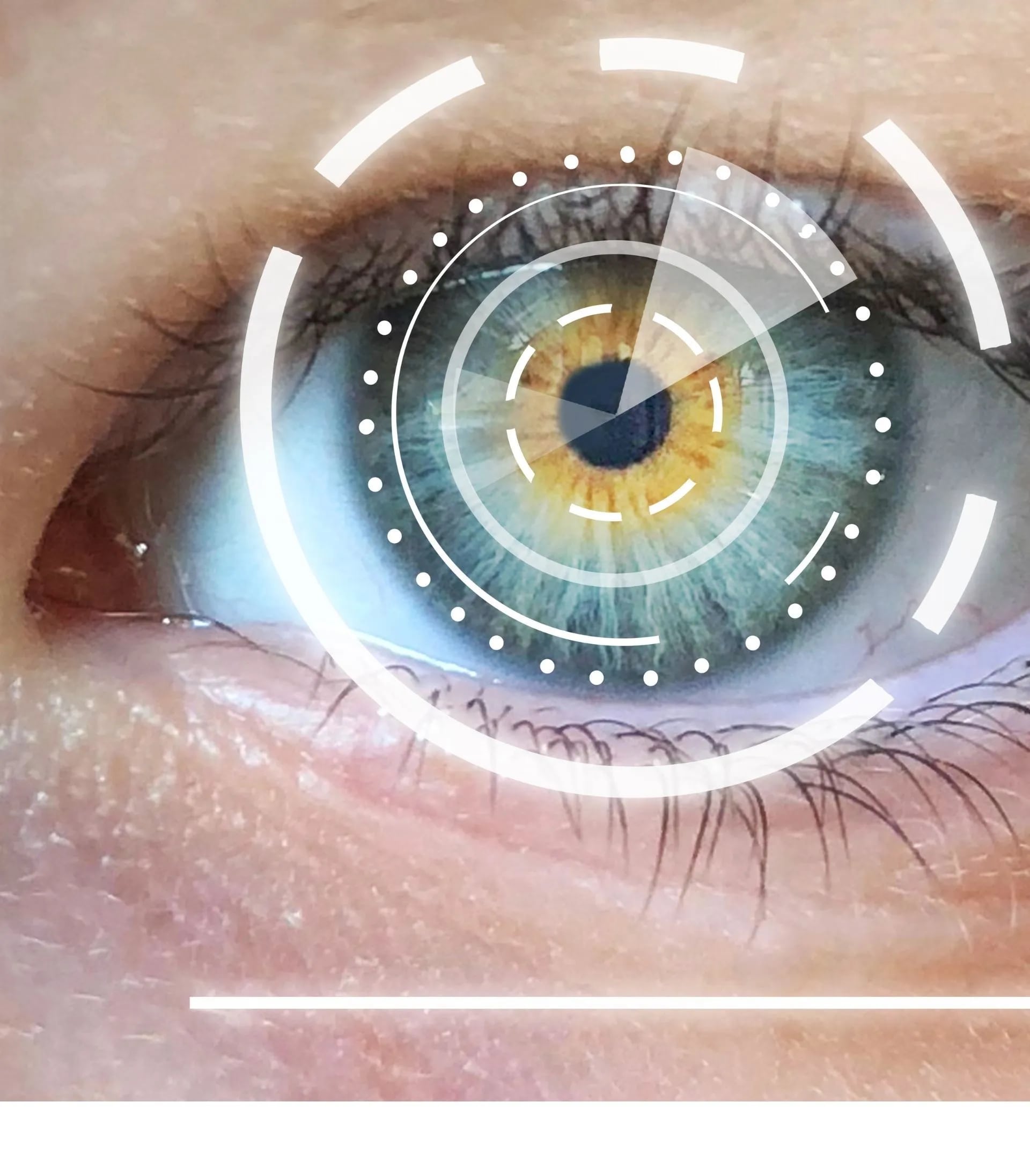 1766076542_SideImageMES2-1920w Eye Floaters Brookfield